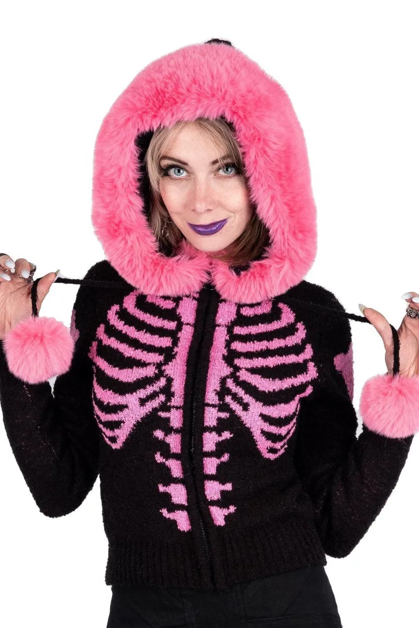 Bony Rib Cage Skeleton Fur Sweater [BLACK/PINK]