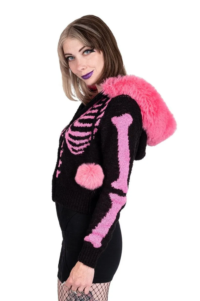 Bony Rib Cage Skeleton Fur Sweater [BLACK/PINK]