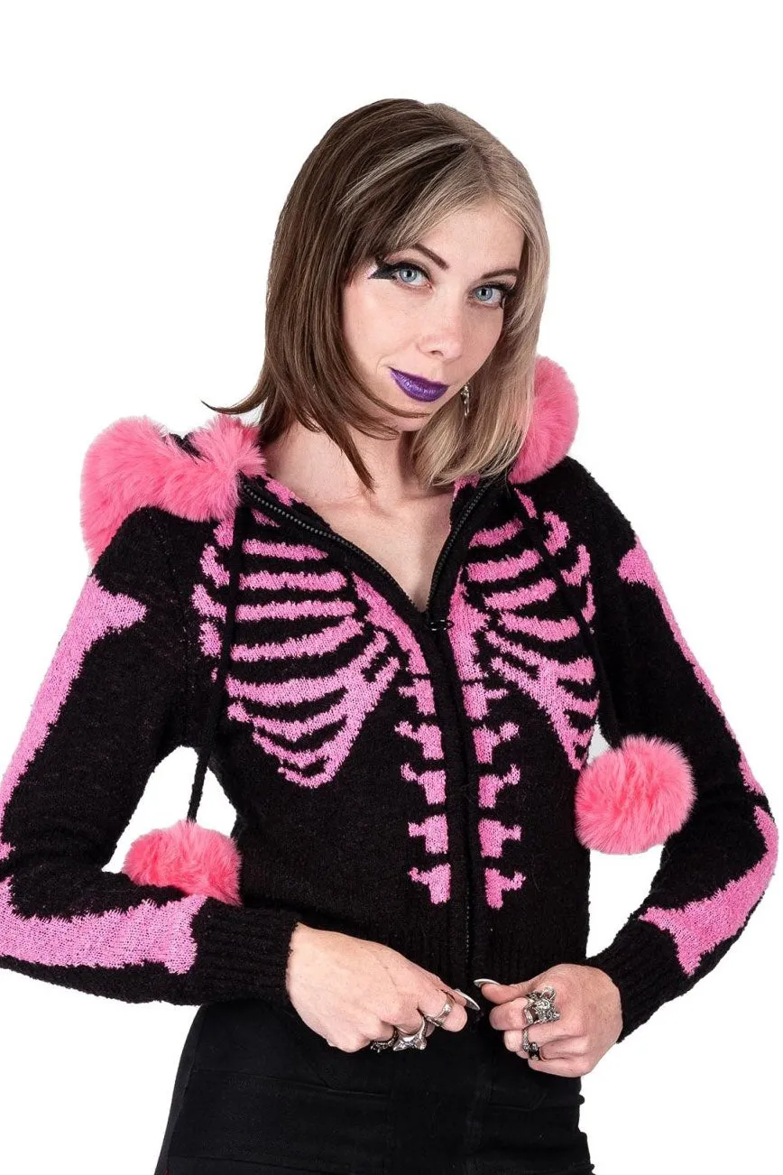 Bony Rib Cage Skeleton Fur Sweater [BLACK/PINK]